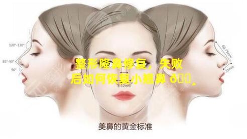 整形隆鼻修复，失败后如何恢复小翘鼻 🕸